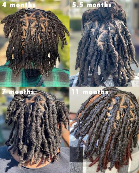 Triangle Locs, Triangle Locs Parts, C Shaped Parting Locs, Locs With Barrel Ends, Triangle Parts Locs, C Shape Loc Parts, 200 Locs Count, Locs With Loose Ends, Afro Braids