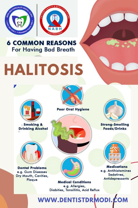 Halitosis - 6 common reasons of having bad breath - tips by dentist Breath Drawing, Get Rid Of Bad Breath, Healthy Liver Diet, Dental Appointment, Causes Of Bad Breath, Dental Advertising, Prevent Bad Breath, Foot Reflexology Massage, Dental Social Media