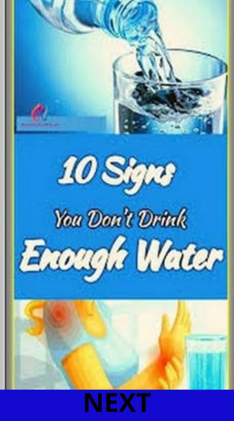 10 signs that you are not drinking enough water! Drinking Enough Water, Not Drinking Enough Water, Healthy Living Inspiration, Healthy Mindset, Healthy Skin Care, Health And Beauty Tips, Healthy Mind, Healthy Living Tips, Nutrition Tips