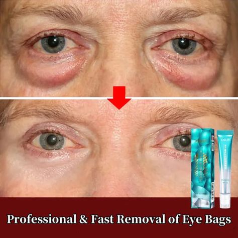 7 Day Tighten Wrinkles Eye Cream Anti Dark Circles Bags Puffiness Fade