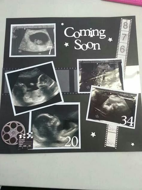 5 pictures, ultrasound, baby, pregnancy Pregnancy Scrapbook Ideas, Ultrasound Scrapbook, Family Album Design, Scrapbook Baby Book Ideas, Photo Albums Diy, Baby Boy Scrapbook Layouts, Pregnancy Scrapbook, Scrapbook Bebe, Baby Book Ideas