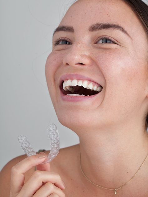 Dental Posts, Dental Photography, Clear Braces, Straight Teeth, Clear Aligners, Teeth Straightening, Health Technology, Healthy Smile, Aesthetic Beauty