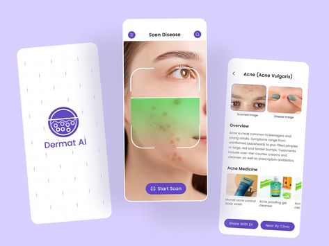 Dermat AI- Skin Disease Scan App by 300Mind UI/UX for 300Mind on Dribbble 3d Game Art, Game Art Design, Concept Art Character Design, Acne Medicine, Scan App, Acne Vulgaris, Concept Art Character, Facial Recognition, Skin Diseases