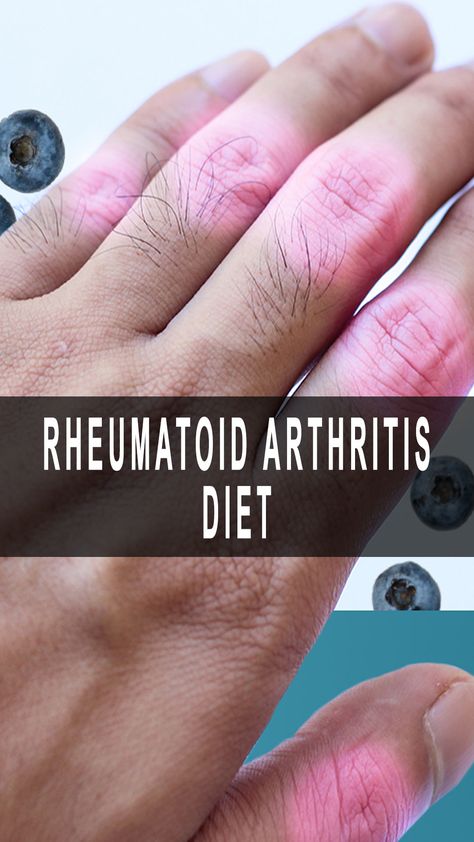 Rheumatoid Arthritis Diet Rheumatoid Diet, Autoimmune Disease, Lungs, Blood Vessels, How To Stay Healthy, Natural Remedies, Your Skin, Health Tips, Disease