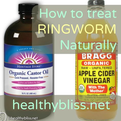 How To Get Rid Of Ring Worms On Skin, Natural Ring Worm Remedies, Ring Worm Essential Oils, Ringworms In Humans Remedies, Deworming Humans Diy, Ring Worm Remedies, Sick Tips, Illness Remedies, Diy Toiletries