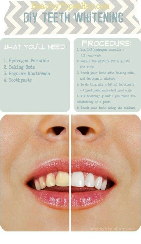 DIY Tooth whitening with baking soda, mouthwash, toothpaste and hydrogen peroxide. Teeth Whitening Procedure, Teeth Whitening Homemade, Whitening Teeth, Teeth Whitening Diy, Diy Teething, Body Hacks, Super White, Tooth Decay, Mouthwash