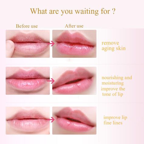 Collagen Lip Mask, Lips Care, Make Up Tutorials, Natural Hair Mask, How To Grow Eyebrows, Boost Hair Growth, Hair Growth Faster, Hydrating Mask, Lip Fillers