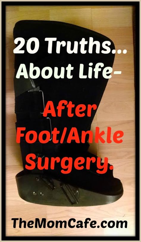 20 Truths about Life after Foot Ankle Surgery Fractured Ankle Recovery, Lisfranc Surgery Recovery, Ankle Injury Recovery, Trimalleolar Fracture Recovery, Ankle Surgery Recovery Tips, Trimalleolar Fracture, Ankle Fracture Recovery, Torn Ligament In Ankle, Fractured Ankle