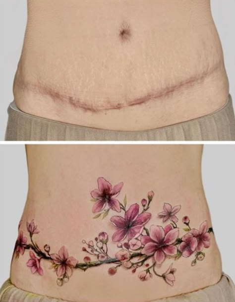 Tattoo Over Large Scar, Gallbladder Scar Tattoo Cover Up, Belly Side Tattoo, Mastectomy Tattoo Flat, Belly Scars Cover Up Tattoo, Tummy Scar Tattoo, Strechmark Tatoos, Post Mastectomy Tattoo, Breast Lift Tattoo Cover Up