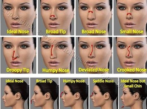 Make Up Shadow, Crooked Nose, Nose Types, Broken Nose, Turmeric Health, Nose Contouring, Nose Shapes, Nose Job, Trendy Makeup