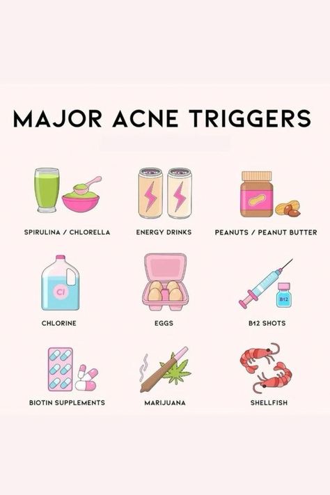 Acne Triggering Foods, Tips To Prevent Acne, How To Prevent Acne Breakouts, Hormonal Acne Routine, Foods That Are Bad For Your Skin, Skin Care For Breakouts, Acne Trigger Foods, Foods That Trigger Acne, Hormonal Acne Diet Clear Skin