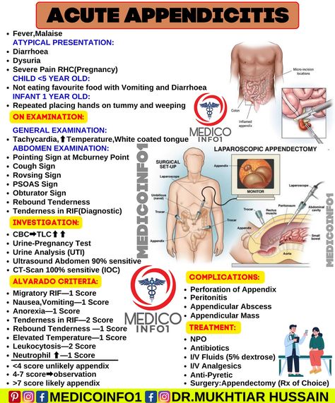 Acute Appendicitis #medicoinfo1 #medical #medicalstudent #medicalschool #medicine #medico #mbbs #mbbsstudent #mednotes #pharmacology #physiology #pathology #anatomy #microbiology #health #usmle #doctor #nurse General Surgery Notes, Appendix Surgery, Medical Laboratory Science Student, Nursing School Essential, Medicine Notes, Basic Anatomy And Physiology, Nurse Study Notes, Nursing Student Tips, Pharmacology Nursing