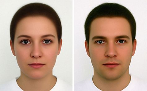 Facial masculinization surgery in ... Face Transformation, Chin Implant, Average Face, Facial Contouring, Lip Augmentation, Upper Lip, Plastic Surgeon, Cosmetic Surgery, Portrait Artist