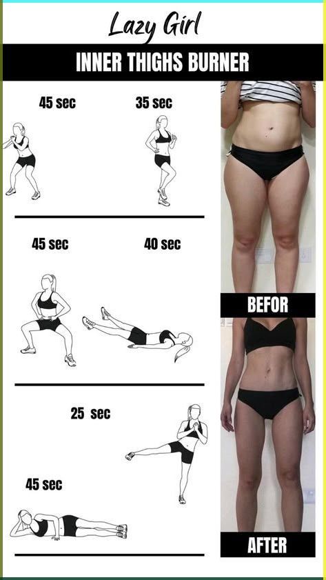 Loose Thigh Fat Exercises, Thigh Dimples Workout, Flat Thigh Workout, Skinnier Thigh Workouts, Loos Weight Workout, Fast Slim Thigh Workout, Easy Workouts To Lose Leg Fat Fast, Exercise To Lose Leg Fat Fast, Thigh Loose Exercise