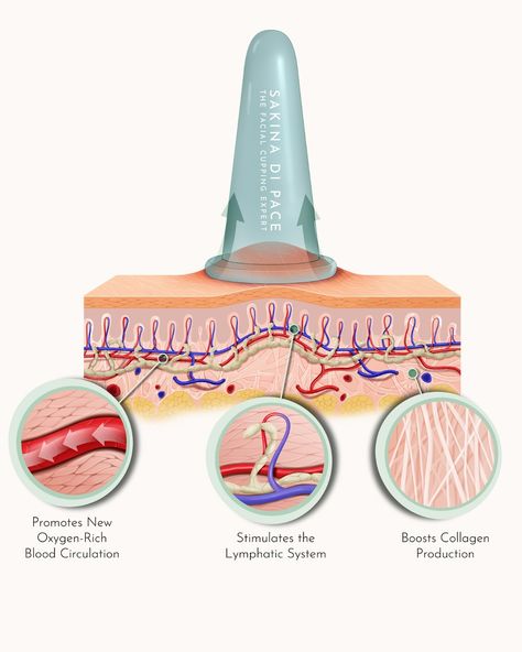 ABOUT FACIAL CUPPING… How does facial cupping work? Let me try to answer this question as simply as I can. By delicately lifting the layers of your skin, facial cupping creates space for improved circulation of blood, lymph, and Qi, fostering a healthier complexion from within. This process not only promotes the release of tension and fascia adhesions, which can lead to wrinkles and sagging, but also triggers the skin’s natural healing response. Through controlled suction, facial cupp... Cupping Techniques, Esthetician Notes, Massage Steps, Face Cupping, Esthetician Facial, Facial Massage Steps, Lymph Flow, Esthetician Inspiration, Facial Cupping