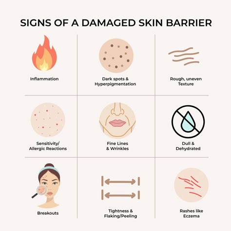 Damaged Skin Barrier, Skin Facts, Esthetician Marketing, Skin Advice, Skin Science, Skin Clinic, Dehydrated Skin, Skin Barrier, Skin Tips