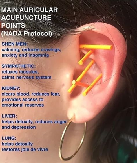 Ear Acupuncture Points, Tcm Traditional Chinese Medicine, Ear Reflexology, Ear Acupuncture, Asian Medicine, Ear Candling, Acupressure Massage, Energy Medicine, Acupuncture Points