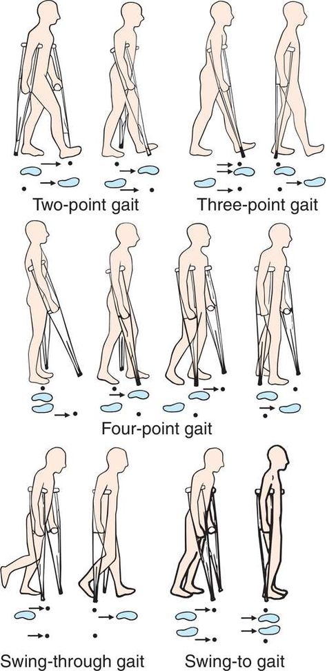 Pta Student Physical Therapist, Gait Exercises, Gait Deviations, Physiotherapy Notes, Gait Patterns, Physical Therapy Assistant Student, Physiotherapy Student, Pt School, Medical Terminology Study