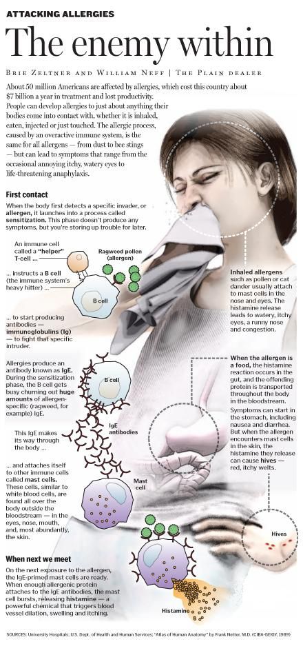 Overactive immune system can spark the allergy chain reaction | cleveland.com Body Knowledge, Paramedic Student, Paramedic School, Science Laboratory, Doctor Advice, Amazing Body, Healthy Diet Tips, Chain Reaction, Green Coffee Bean