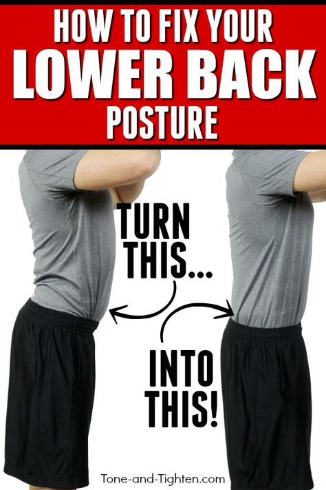 How to fix lower back posture - eliminate "sway back" in 4 simple moves! From the physical therapist at Tone-and-Tighten.com Shoulder Posture, Posture Fix, Sway Back, Back Posture, Hip Problems, Doctor Of Physical Therapy, Pelvic Tilt, Tight Hip Flexors, Posture Exercises