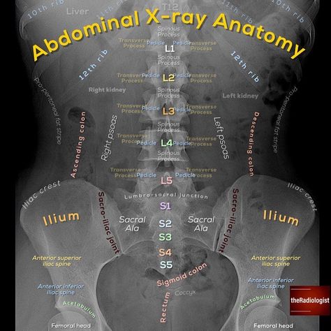 Pinterest || A.J Radiography Student, Radiology Schools, Medical Radiography, Radiology Student, Radiology Technician, Radiology Imaging, Radiology Tech, Medical Student Study, Nursing School Survival