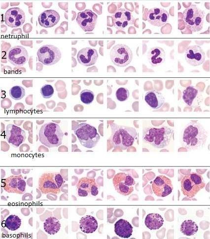 Photos, Google Search, Blood Histology, Red Blood Cells, Leukocyte, Hematology Lab Medical Lab Technician, Vet Tech School, Veterinary Tech, Medical Laboratory Technician, Med Lab, Microbiology Lab, Medical Laboratory Scientist, Pathology Lab, Vet Medicine