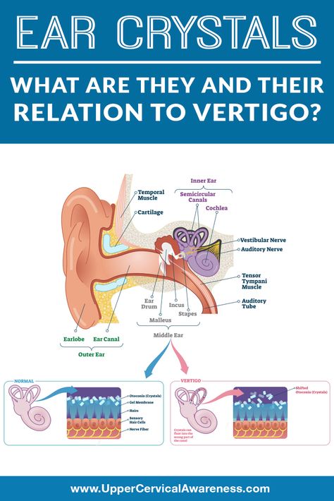 Meneires Disease, Dizziness Remedies, Vertigo Causes, Vertigo Exercises, Vertigo Relief, Vertigo Remedies, Dizzy Spells, The Crystal Gems, Middle Ear