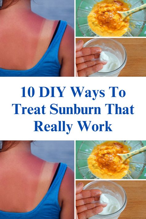 10 DIY Ways To Treat Sunburn That Really Work

10 DIY Ways To Treat Sunburn That Really Work How To Treat Sunburn, Fall Pedicure, Wolf Tattoo Sleeve, Pedicure Colors, Korean Eye Makeup, Pretty Gel Nails, Notes Inspiration, Diy Paper Crafts Decoration, Winter Aesthetic