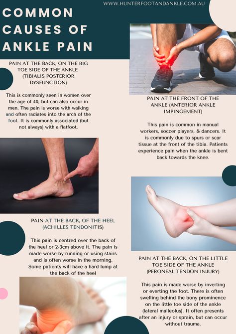 Ankle Health, Ankle Pain Relief, Achilles Pain, Podiatry Clinic, Foot Anatomy, Rehabilitation Exercises, Ankle Surgery, Pain Relief Remedies, 2024 Wishlist