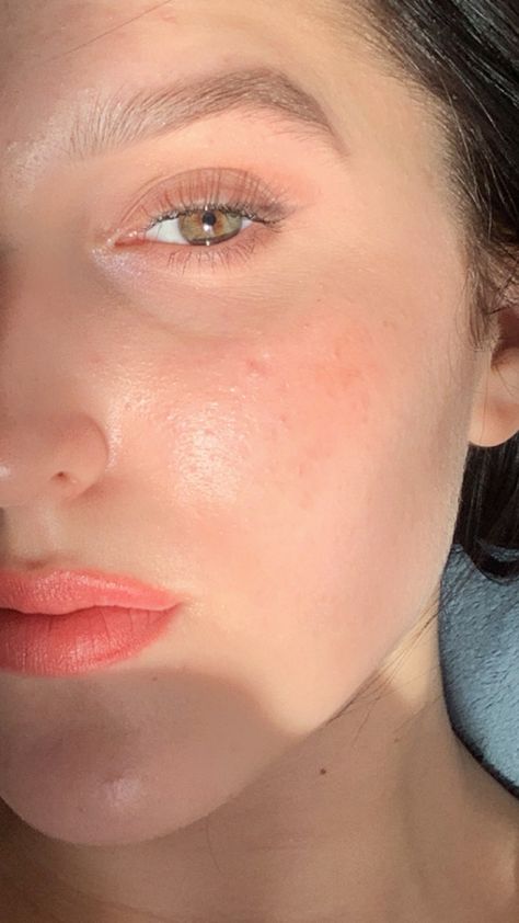 Clear Glowing Skin Photo, Clear Skin Aethstetic, Acne Photos, Glowy Skin Naturally, Korean Glass Skin, Doll Eye Makeup, Clear Glowing Skin, Beauty Routine Tips, Skin Care Spa