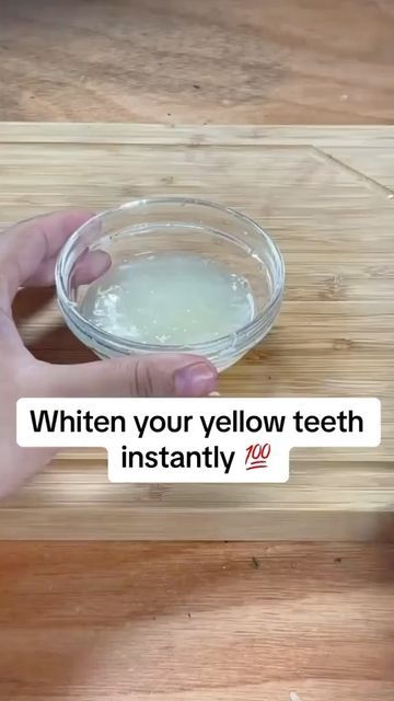 Yellow Teeth Remedy, Teeth Remedies, Tooth Decay Remedies, Teeth Whitening Homemade, Get Whiter Teeth, Teeth Whitening Remedies, Teeth Whitening Diy, Diy Skin Care Routine, Yellow Teeth