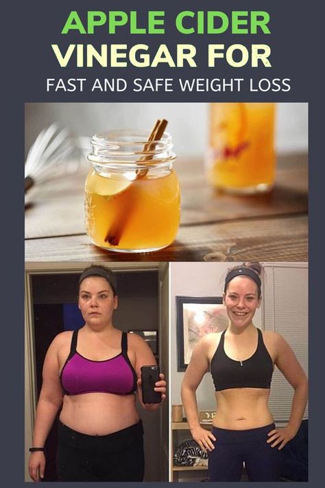 Vinegar Drinks, Apple Cider Vinegar Drink, Baking Soda Beauty Uses, Lose 40 Pounds, Fat Burning Drinks, Lose 50 Pounds, Cider Vinegar, Apple Cider Vinegar, Cayenne