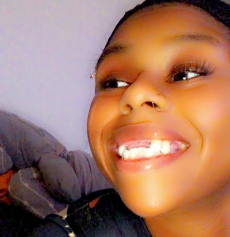 Them: “why you post so much?” Me: “cause I ain’t got no front teeth so every post I’m a molar closer to a fresh set.”🫶🏽🥰 Take Care Of Teeth, How To Maintain Healthy Teeth, Brace Teeth Meme, No Teeth, Front Teeth, Wisdom Teeth Meme, May 21, On Instagram, Quick Saves