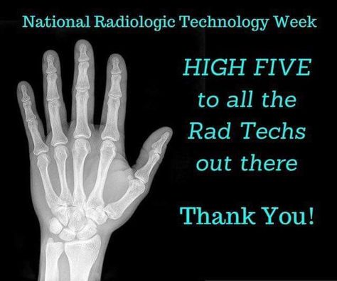 Rad tech week Rad Tech Humor, Radiology Schools, Xray Humor, Medical Radiography, Radiology Humor, Xray Tech Gifts, Rad Tech Week, Radiologic Technology, Morale Boosters