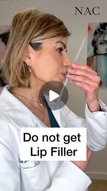 Dr. Bita Zadeh Farrell on Instagram: "#lipfiller #chinfiller #rickettseline #facialbalancing #drbitafarrell #naturalaestheticscenter" Lip Filler Injection, Midface Cheek Filler, Bottom Lip Filler, Lipfiller Before After, Lip Threading, Lip Filler On Small Lips, Natural Looking Lip Fillers, Face Balancing Fillers, Subtle Lip Filler Before And After