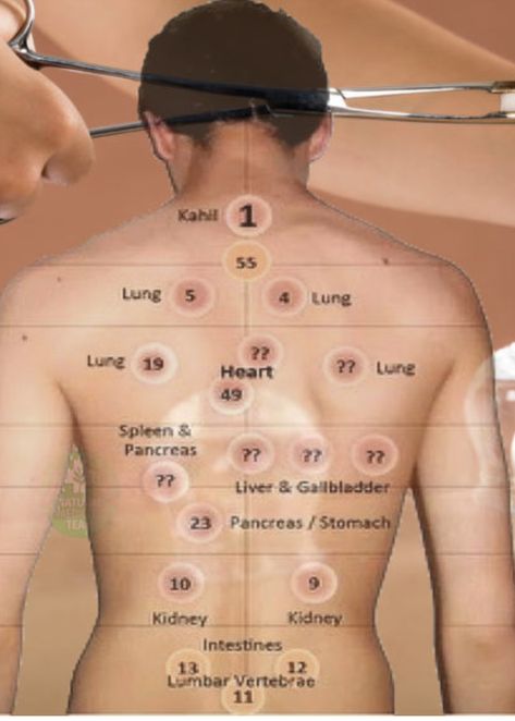 Map of the organs through the back. Labels of lungs, intestines, liver, etc. for where to put the cups. Cupping Marks Meaning, Dry Cupping Therapy Chart, Cupping Therapy Chart Trigger Points, Cupping Placement Chart, Cupping Therapy Chart, Cupping Points, Acupuncture Mat, Pressure Point Therapy, Body Massage Techniques