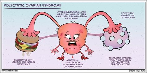 istudyiwin: “Wanted to share these because I love them! All credits to: medcomic.com ” Nursing Mnemonics, Polycystic Ovarian Syndrome, Med Surg, Medical School Studying, Medical Examination, Nursing Tips, Nursing Study, Nursing Education, Nursing Notes