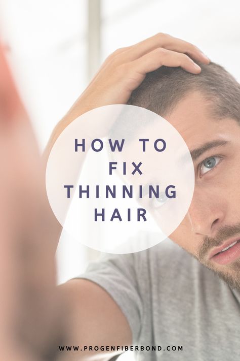 How To Fix Thinning Hair, Fix Thinning Hair, Thining Hair, Thicker Stronger Hair, Thinning Hair Remedies, Bald Look, Hair Growth Cycle, Hair Thinning, Regrow Hair