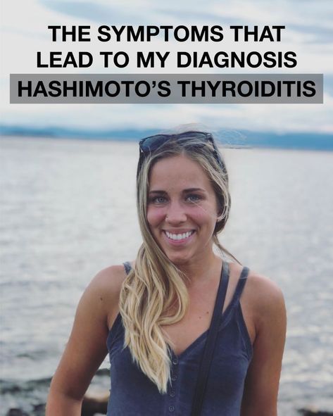 Thyroid Issues Signs, Hashimotos Disease Symptoms, Hashimotos Symptoms, Thyroid Exercise, Autoimmune Disease Symptoms, Yoga Information, Thyroid Symptoms, Hashimotos Disease, Thyroid Issues