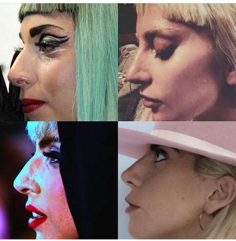 Before and After surgery - Lady Gaga Lady Gaga Nose, Lady Gaga Nails, Lady Gaga Before, Nose Jobs, Rhinoplasty Nose Jobs, Rhinoplasty Surgery, Lady Gaga Photos, Lady Gaga Pictures, Celebrity Plastic Surgery