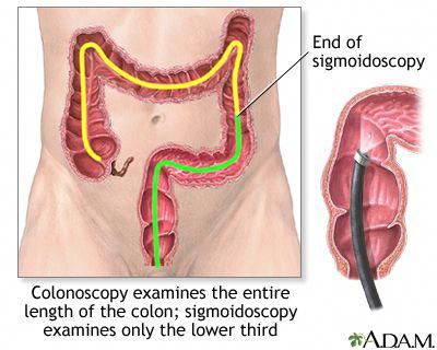 noindex, nofollow" name="robots"/><meta itemprop="description Lung Detox, Surgical Technologist, Bowel Movement, Lower Thirds, Large Intestine, Digestive Health, Medical Professionals, Surgery, Disease