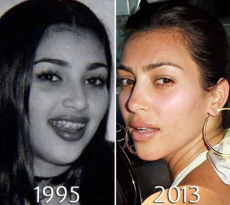 Kardashian Plastic Surgery, Kylie Jenner Plastic Surgery, Young Kim Kardashian, Kim Kardashian Before, Plastic Surgery Fail, Plastic Surgery Photos, Celebs Without Makeup, Facial Plastic Surgery, Celebrity Plastic Surgery