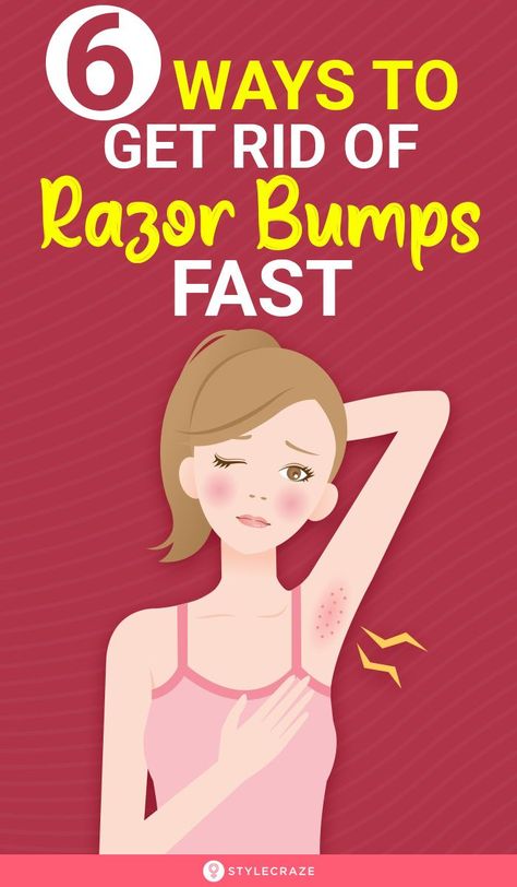 Best Home Remedy For Razor Bumps, How To Not Have Razor Bumps Down There, Get Rid Of Shaving Bumps Bikinis, How To Fix Razor Burn Fast, What Helps With Razor Bumps, Treating Razor Bumps Bikinis, Getting Rid Of Razor Bumps, How To Get Rid Of Razor Bumps Down There, How To Get Rid Of Armpit Bumps