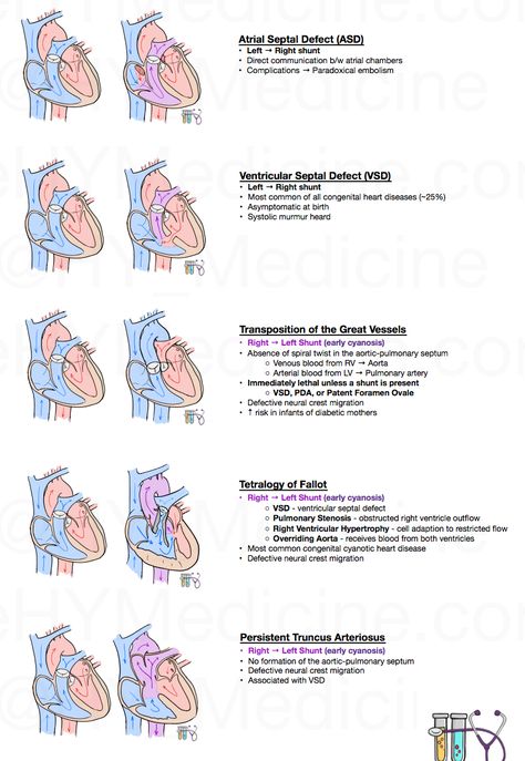 Echo Cardiography, Step Exam, Ekg Leads, Cath Lab Nursing, Peds Nursing, Medical Things, Usmle Step 1, Nurse Things, Child Nursing