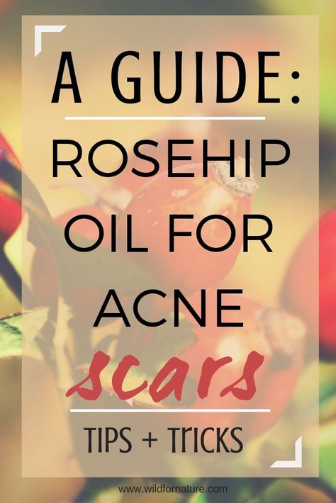 Click to see how you can minimize the appearance of acne scars with rosehip seed oil! Tips on the best rosehip oil for acne scars inside and simple DIY recipes!  #diybeauty #diyskincare #veganbeauty #carrieroils  #naturaloilsskincare #naturaloilsforskin # Rosehip Oil Benefits Skincare, Rosehip Seed Oil Benefits, Scar Healing, Amber Oil, Oils Essential, Natural Oils For Skin, Ayurvedic Healing, Skin Natural Remedies, Homemade Products