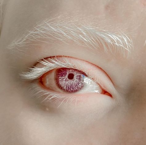 #albino #albinizm #albinoeye Red Eyes Albino, Albino Snake Aesthetic, Albino Girl Aesthetic, Albino Girl Art, Albino Drawing, White Snake Aesthetic, Purple Eyes White Hair, Albino Hair, Purple Eyes Aesthetic