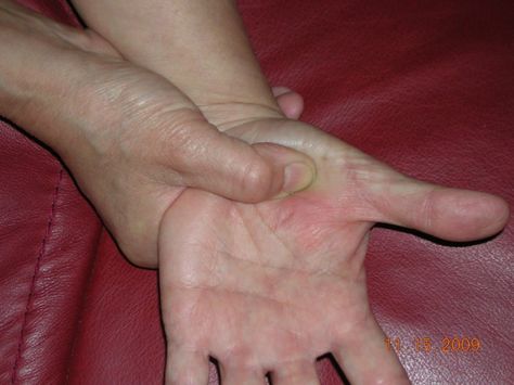 self help, self care, holistic care, sinus and lymphatic drainage hand reflexology tip Sinus Pressure Points, Remedy For Sinus Congestion, Sinus Drainage, Home Remedies For Sinus, Sinus Congestion Relief, Reflexology Points, Pressure Point Therapy, Sinus Infection Remedies, Hand Reflexology