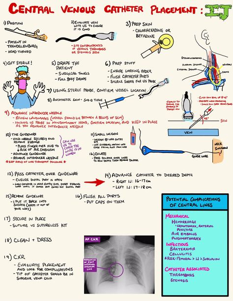 Central Venous Catheter, Central Line, Airway Management, Medical Art, Skin Prep, Critical Care, Business Proposal, Radiology, Nursing School
