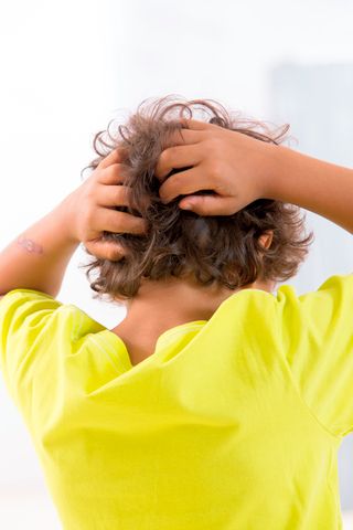 How to Get Rid of Head Lice, in One Easy Guide | Experts explain everything you could possibly need to know to make everyone less itchy and more comfortable. Itchy Head, Scalp Acne, Hair Tips And Tricks, School Social Worker, Head Louse, Parenting Education, Acne Causes, Hair Kids, Hair Tips