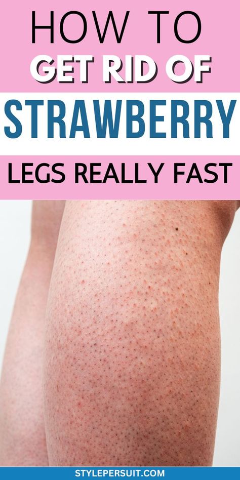 How to Get Rid of Strawberry Legs Fast Bumps On Legs, Exfoliate Legs, Remedies For Dark Lips, Strawberry Legs, Fresh Aloe Vera, Skin Bumps, Shaving Tips, Skin Condition, Beauty Remedies